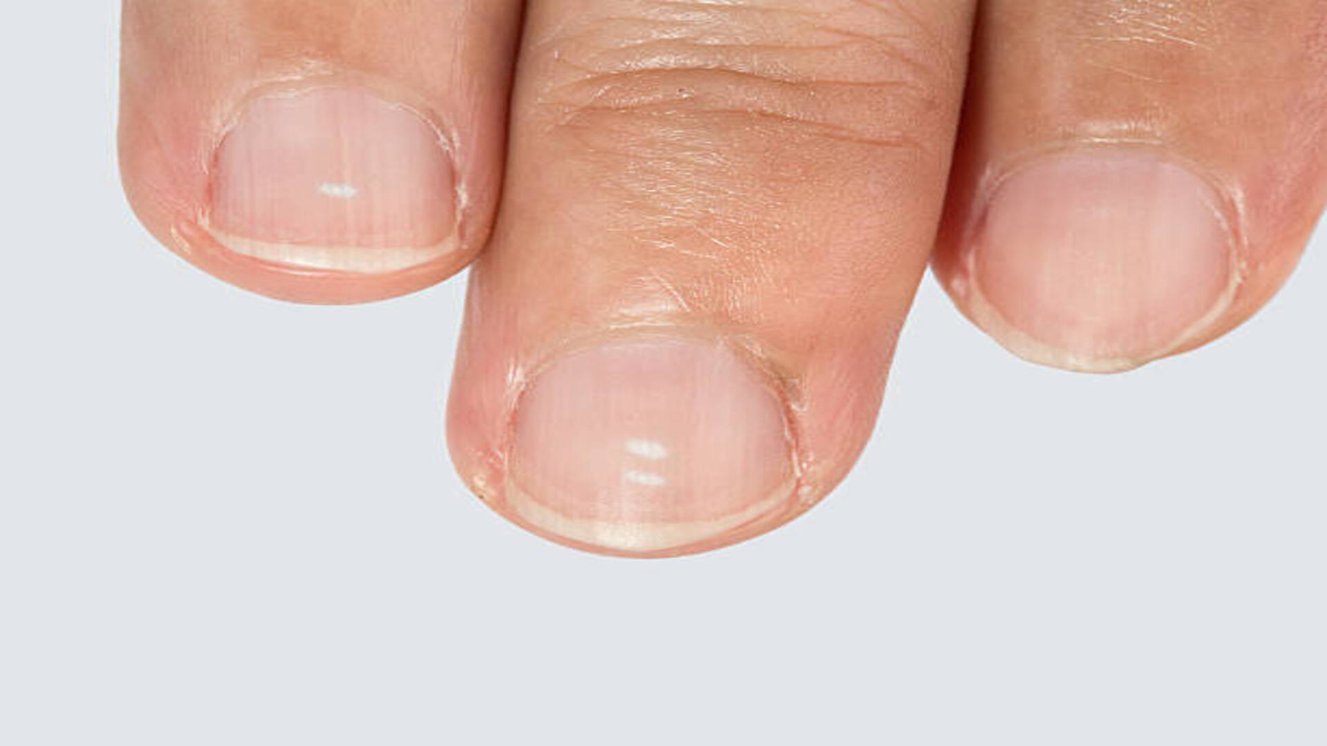 Samudrik Shastra If White Mark On Your Nails Then This Is Sign Lucky or Unlucky for You in Hindi