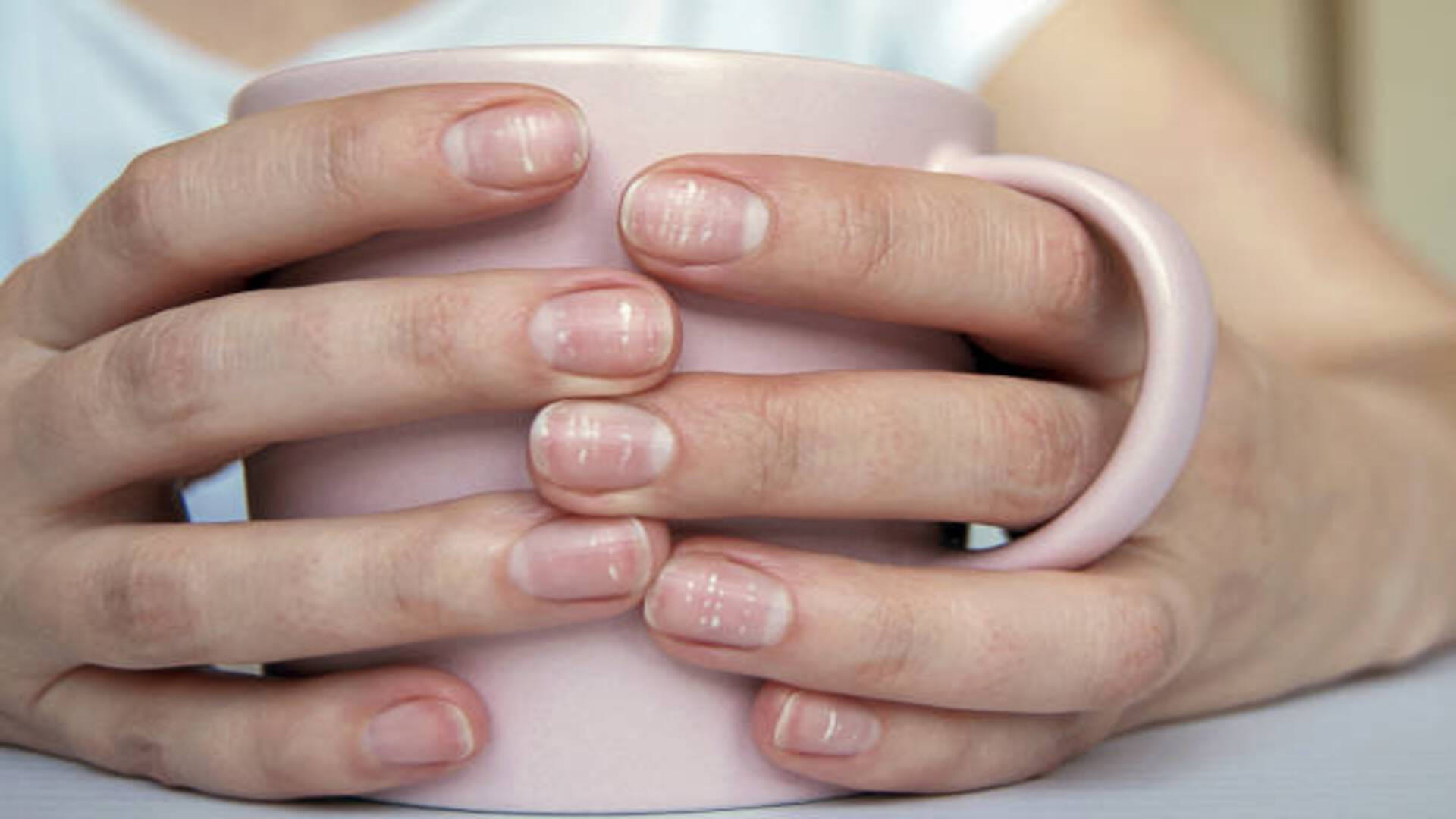 Samudrik Shastra If White Mark On Your Nails Then This Is Sign Lucky or Unlucky for You in Hindi