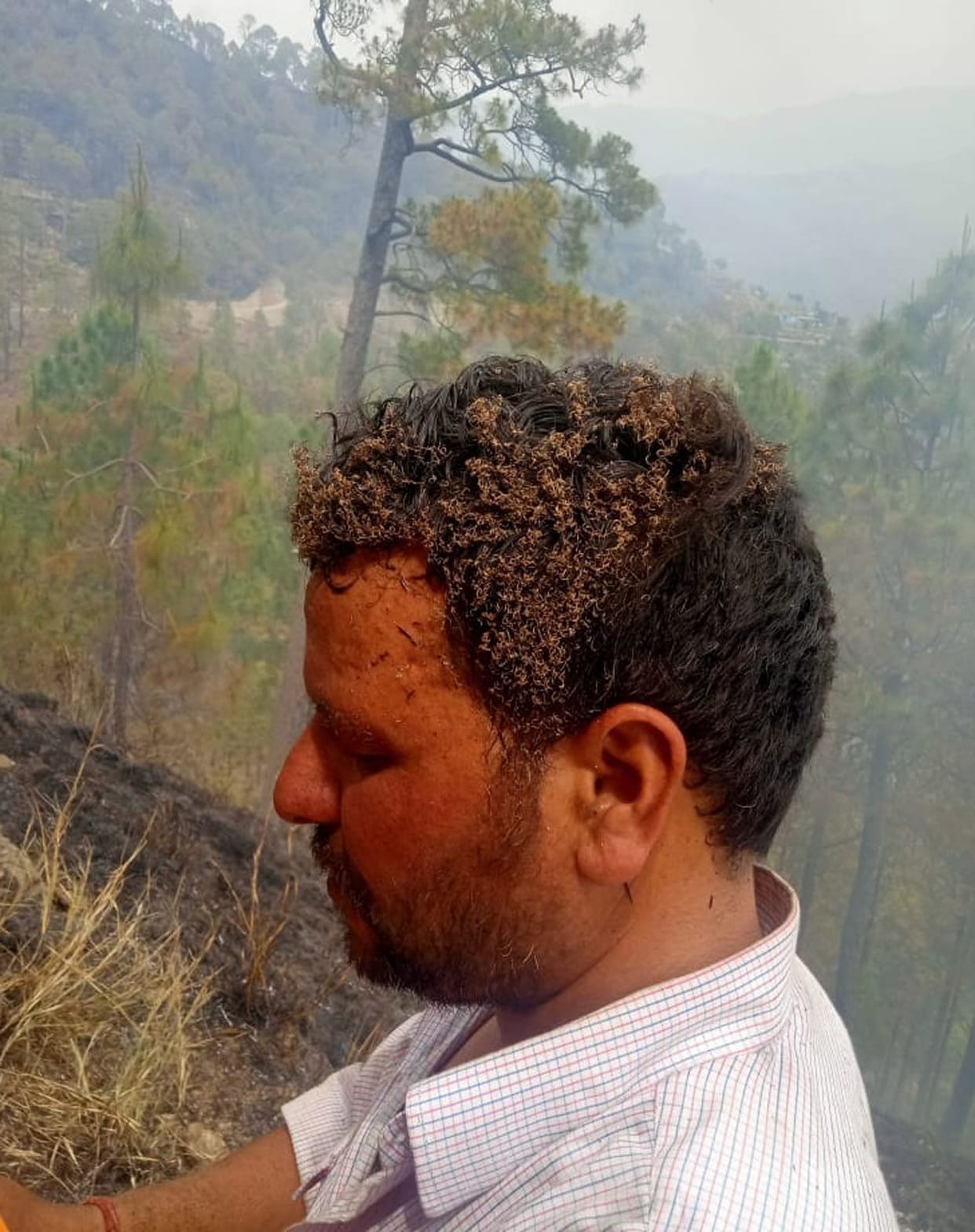 Fire watcher and villager injured while extinguishing the fire