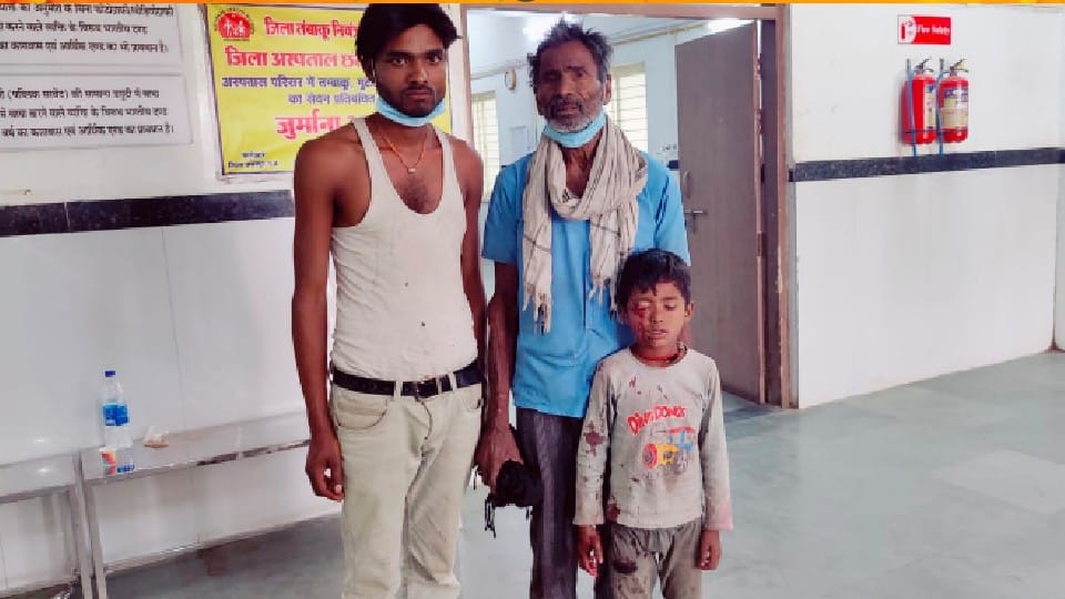 Chhatarpur: Firecracker burst in hand of seven-year-old child, serious injury in hand-eye, admitted to district hospital in bleeding condition