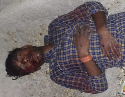 Hathras: Bike collided with divider, one killed, fellow injured