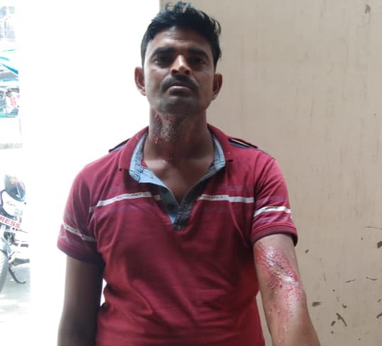 The wire of the high tension line broke down, the youth riding the bike got scorched