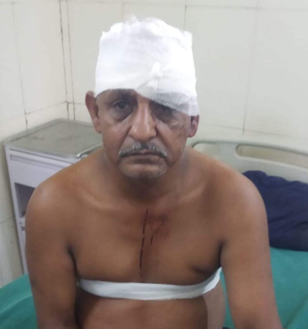 Bike riding miscreants shot the farmer, referred