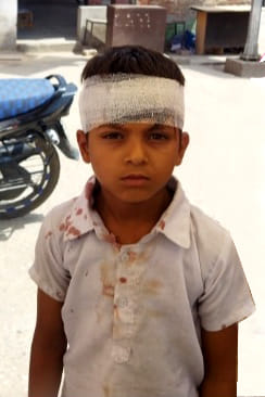 Seven-year-old boy hit a brick in the head