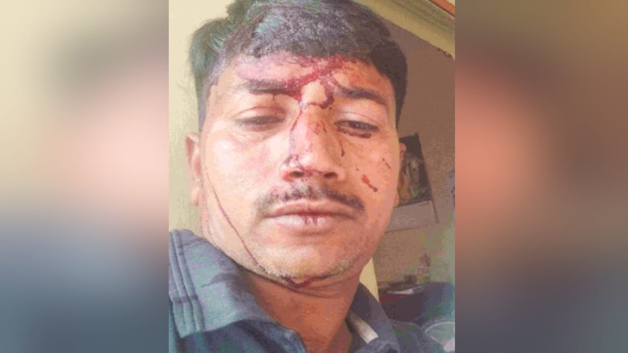Greater Noida environmentalist head broken for stopping a person from burning garbage