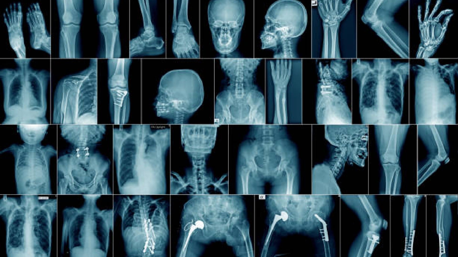 Ancestors Height Decreased by Farming Know What Scientist Study Revealed News In Hindi