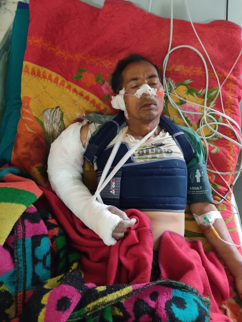 Four Injured in Mine Accident