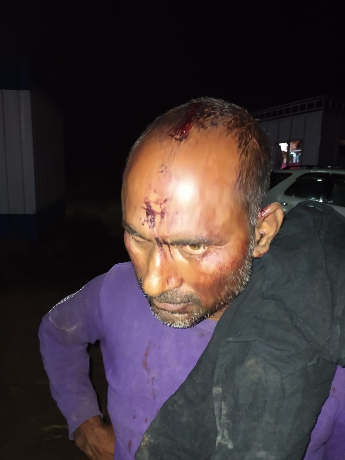 police,report,FIR,ASP,black