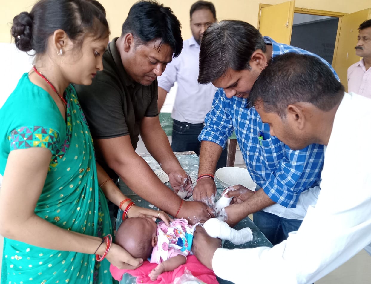 Kanpur Dehat: Children with crooked claws will be treated in the district hospital from next week