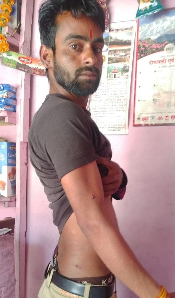 Tiger Attacked to Youth