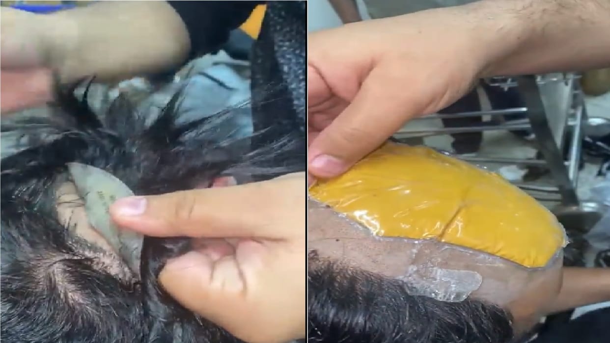 gold smuggling Abu Dhabi passenger arrested with gold concealed inside his wig rectum