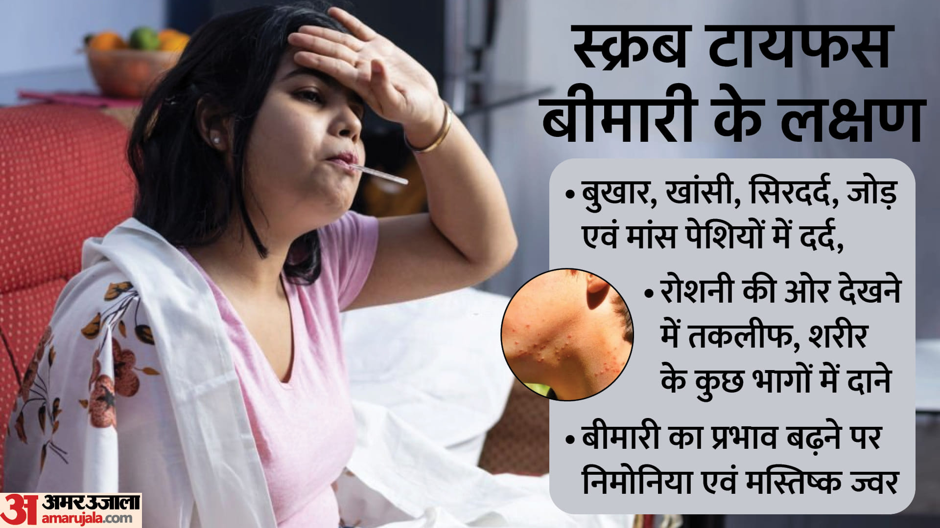 स्क्रब टायफस के लक्षण।