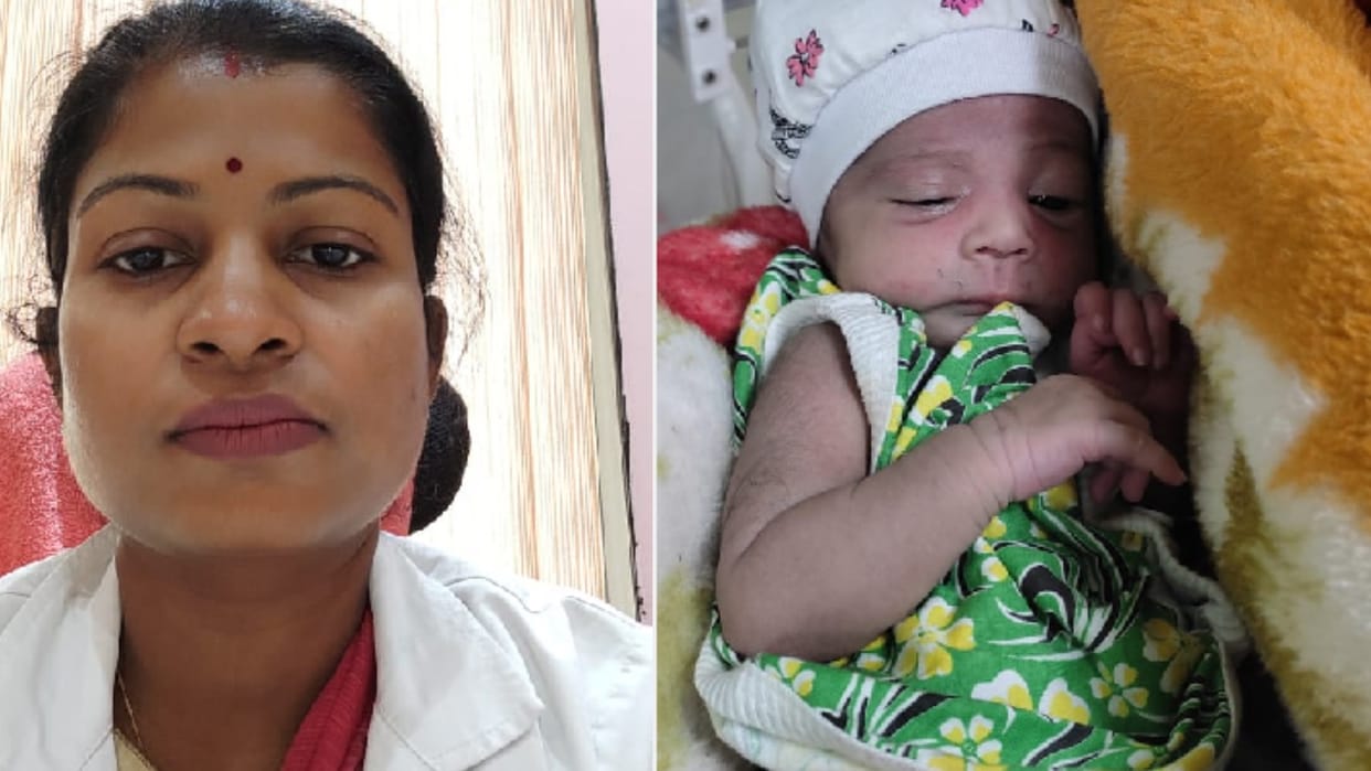Newborn life saved by operating underdeveloped intestine in Gorakhpur BRD