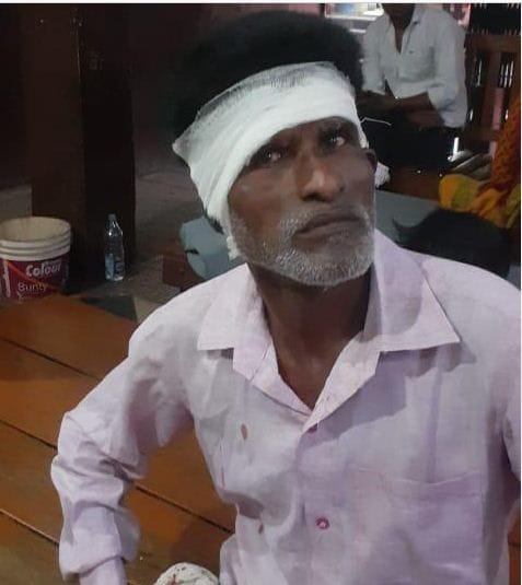 Hathras: Monkeys getting violent, a person's ear cut off in Gausganj