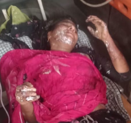 Youth attacked with knife, acid poured on mother