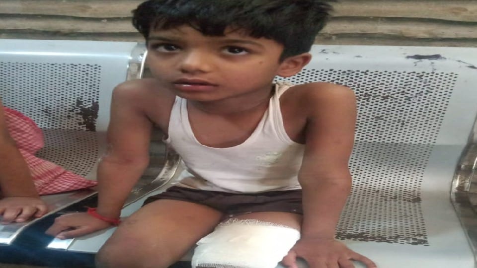 students hurt due to School van radiator explodes in vrindavan mathura