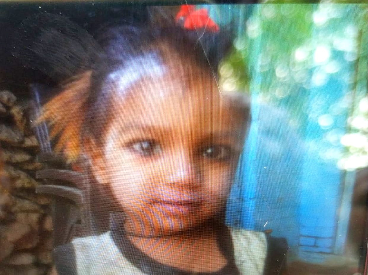 three year old kid drinks diesel accidentally dies in kanpur