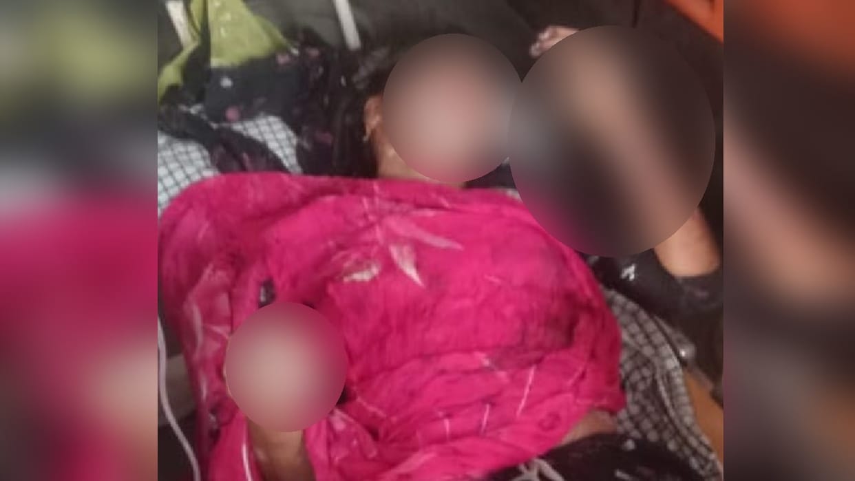 Iron smelting acid kept in the house woman drank it