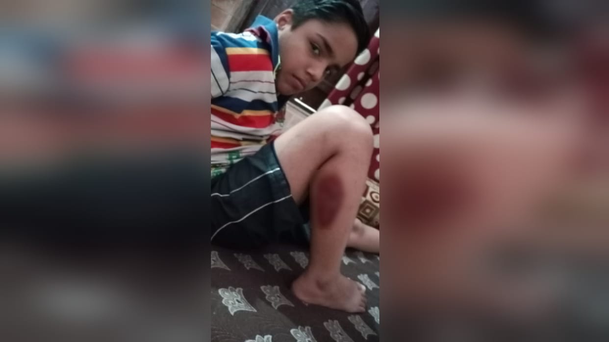 UP News: dogs have attacked son of a BJP leader in Meerut