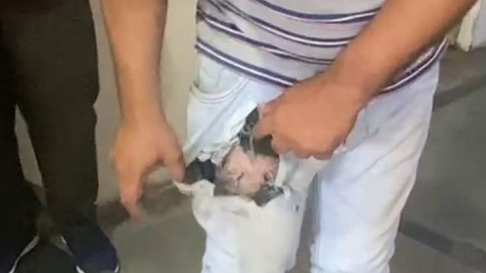 Ujjain: Mobile kept in jeans pocket cracked and caught fire, youth's hands and feet were scorched, had to be taken to hospital