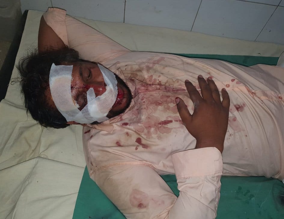 Attack on youth by calling on the pretext of Eid feast, attempt to bite tongue