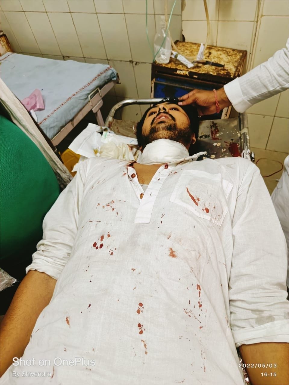 The neck of the SP Metropolitan President's son was severed, got nine stitches.