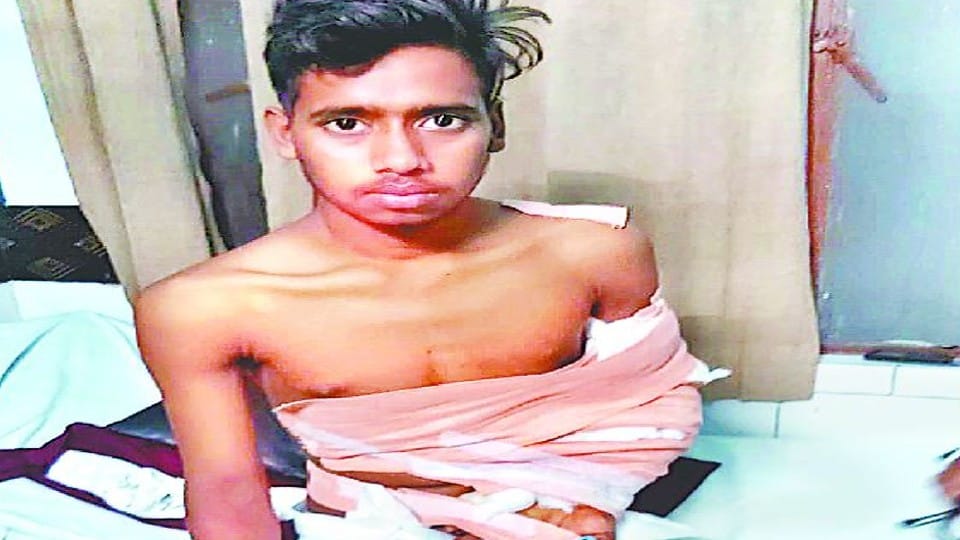 agra doctors save student hand by surgery his right hand cut in road accident