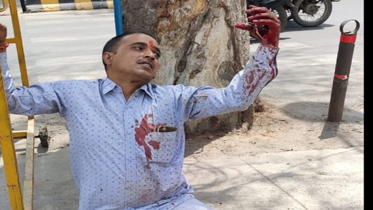Guard gun fired in Civil Lines, himself injured
