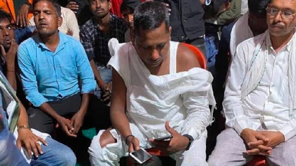 Singrauli: Congress leaders were doing serpent dance while intoxicated, villagers kicked and punched, torn kurta