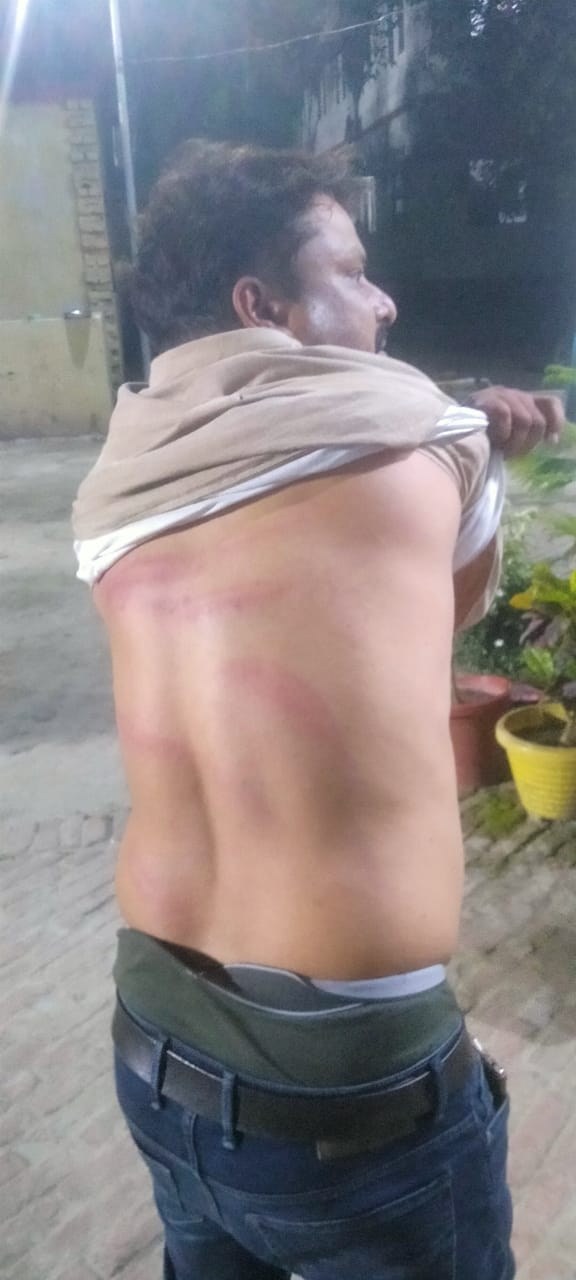 Two including the branch manager of the bank were beaten up by miscreants