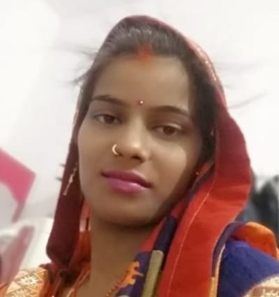 an woman burnt in miserable conditions