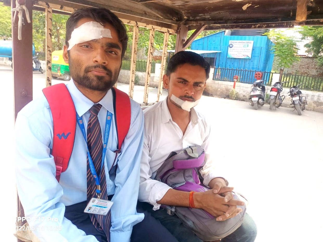 Uncontrolled e-bus collides with tree in Kanpur, half a dozen passengers injured