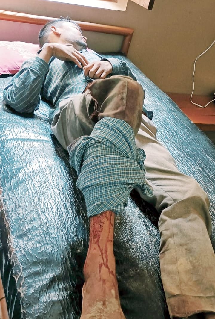 Uncle-nephew who went to harvest fodder was attacked by a herd of indigo cows, one injured