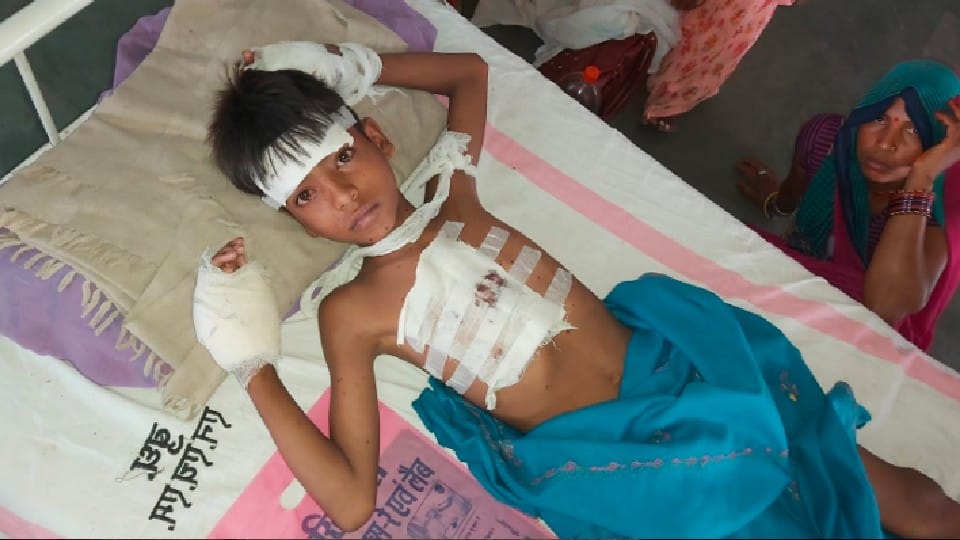 Blast in mobile battery in Chhatarpur: serious injuries to the paws, head and chest of the child, the child was driving the motor from the battery