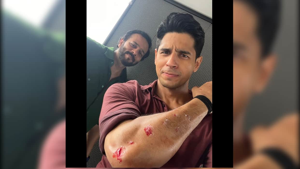 Sidharth Malhotra injured during the shooting of rohit shetty indian police force, shared the photo and show the injury