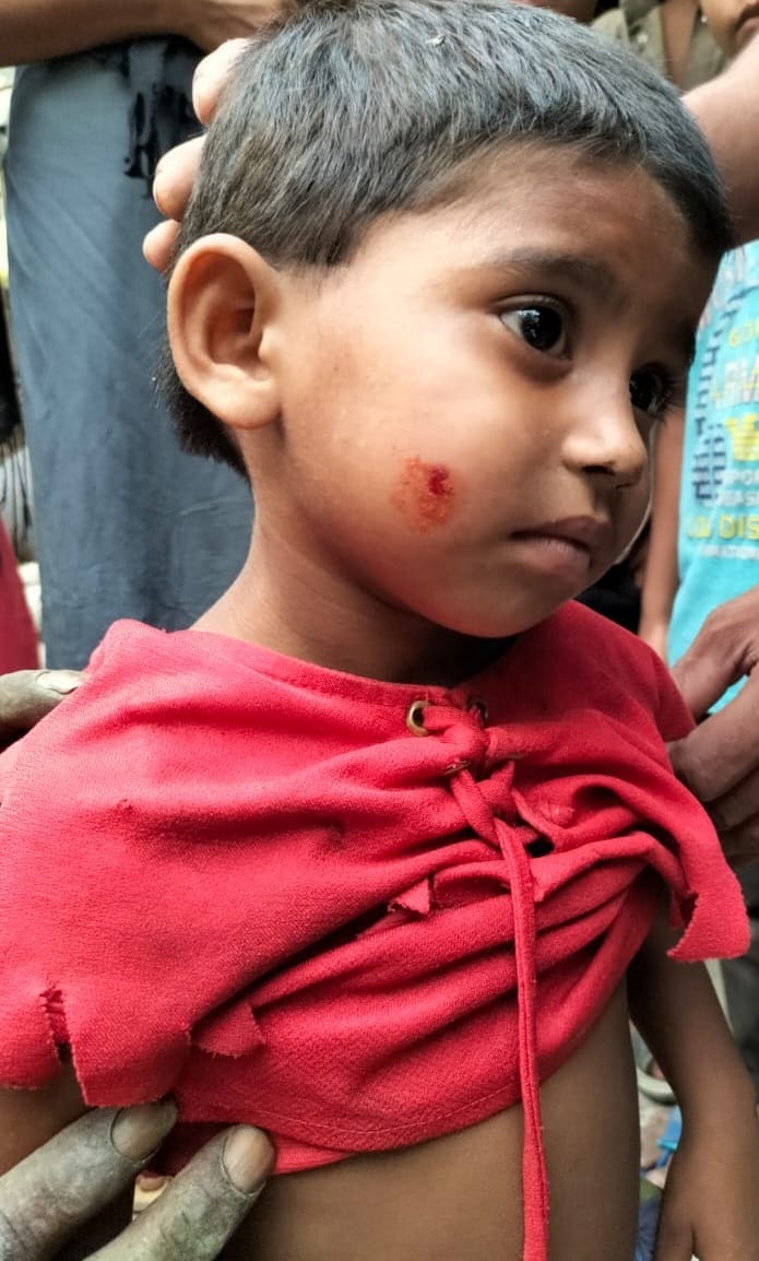 Dogs attacked and injured the girl