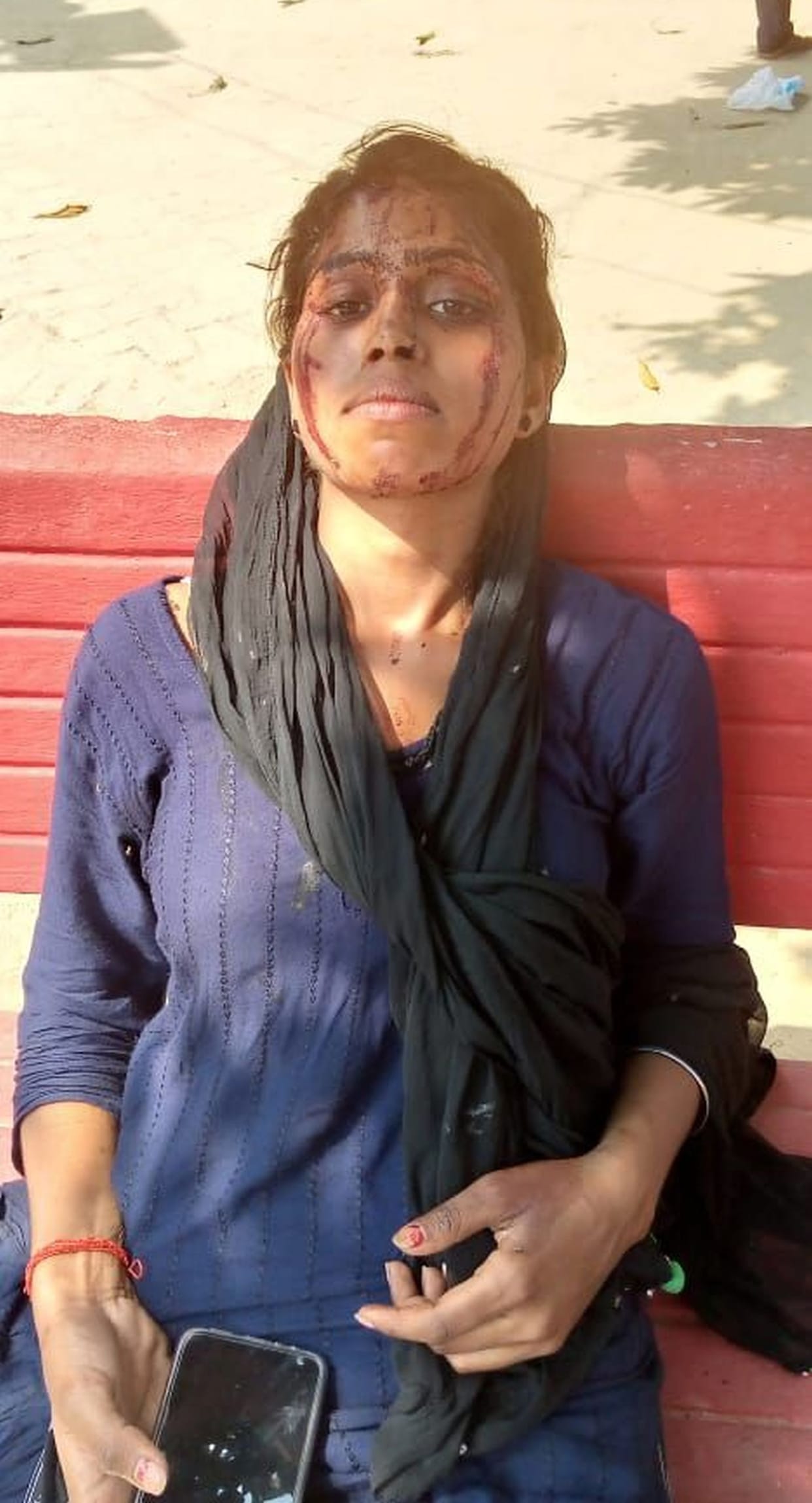 The girl injured by the beating reached the police station, the police returned
