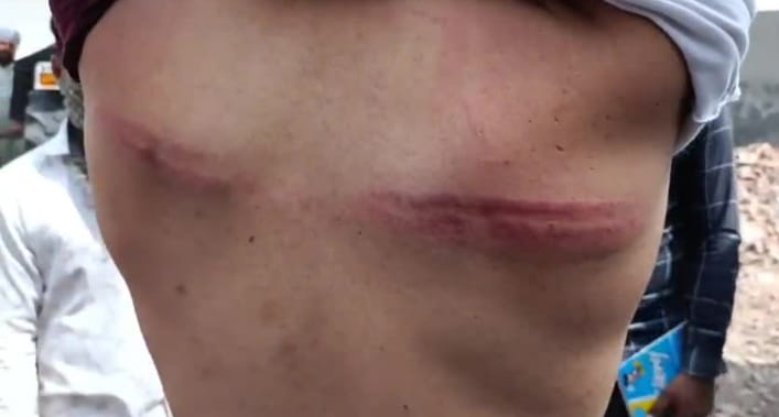 The employees who went to collect the electricity bill were badly beaten by villagers