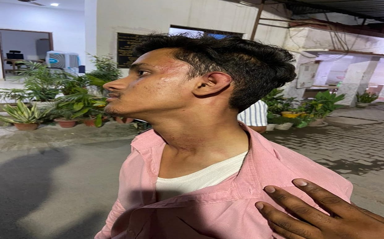 Daroga of Lanka police station suspended in case of beating of BJP leader in varanasi case registered against 5 policemen