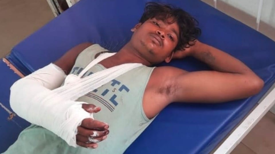 Chhindwara News: Attack of wild boars in Chhindwara, four farmers going to the fields injured, one in critical condition