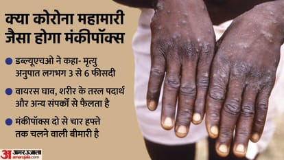 Monkeypox: Know all about the Virus, symptoms and treatment News in Hindi