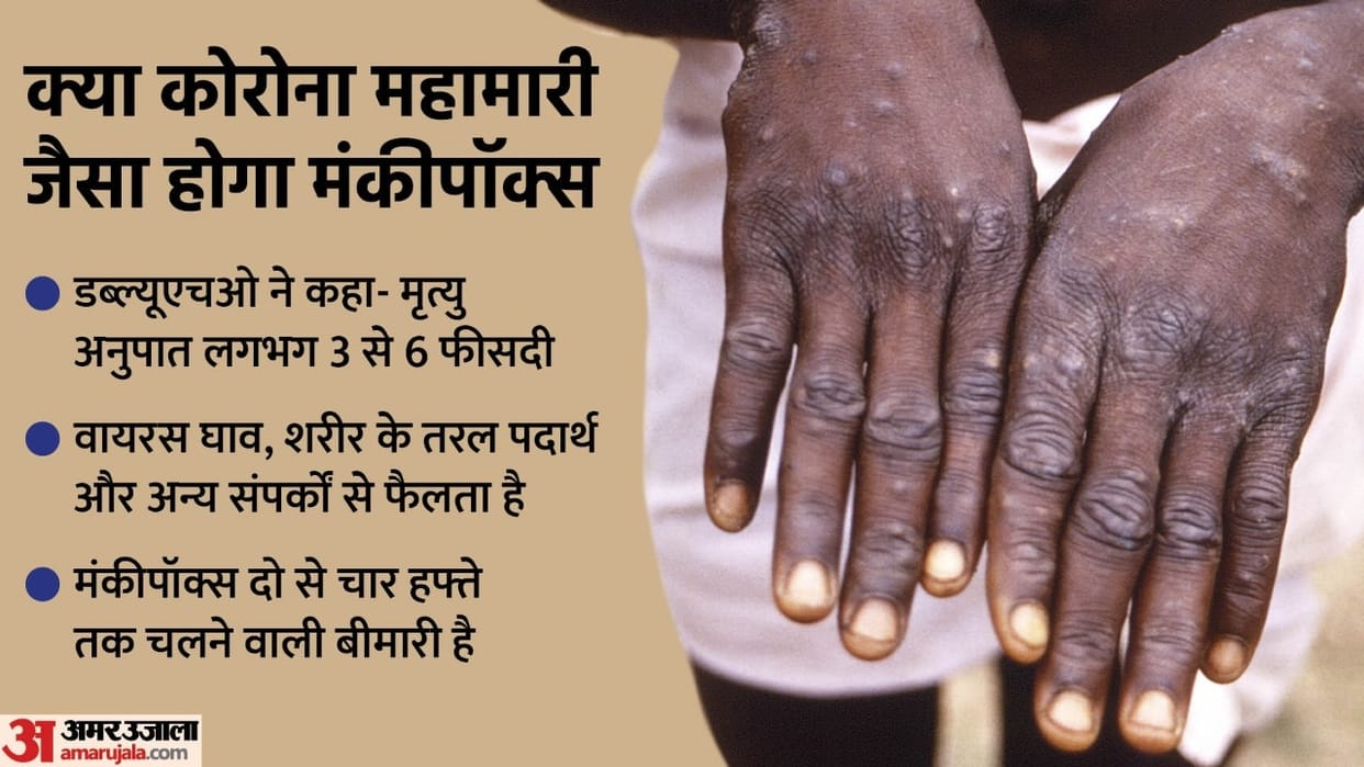 Monkeypox cases may increase, World Health Organization warns, know 10 big things