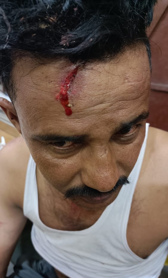 Family attacked by entering the house, four including woman injured