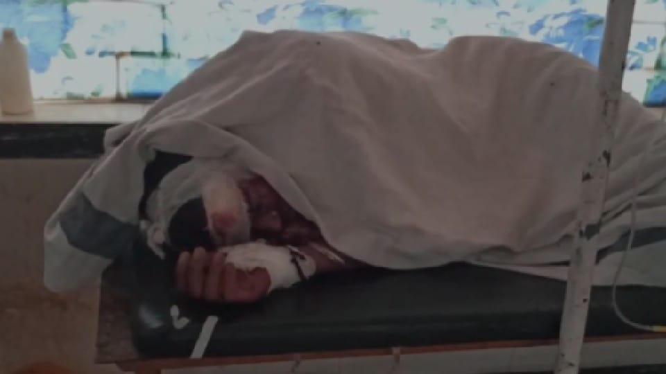 Three Died in Satna Due to Storm: Three people died, four injured due to being buried under a tree uprooted by the storm and the visor collapsed