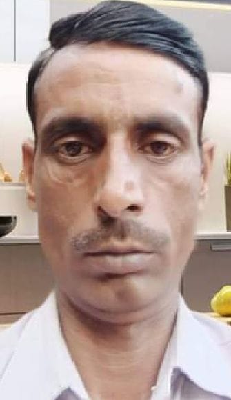 Pradhan's son died before lightning struck, friend scorched