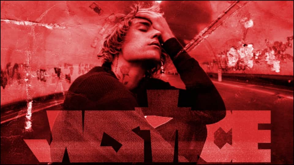 Justin Bieber Reveals of Face Paralysis Ramsay Hunt Syndrome Latest News in Hindi