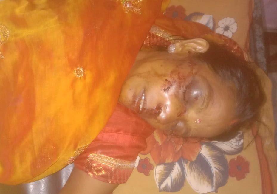 Pickup full of devotees going to Maihar collided with the culvert, 12 people serious