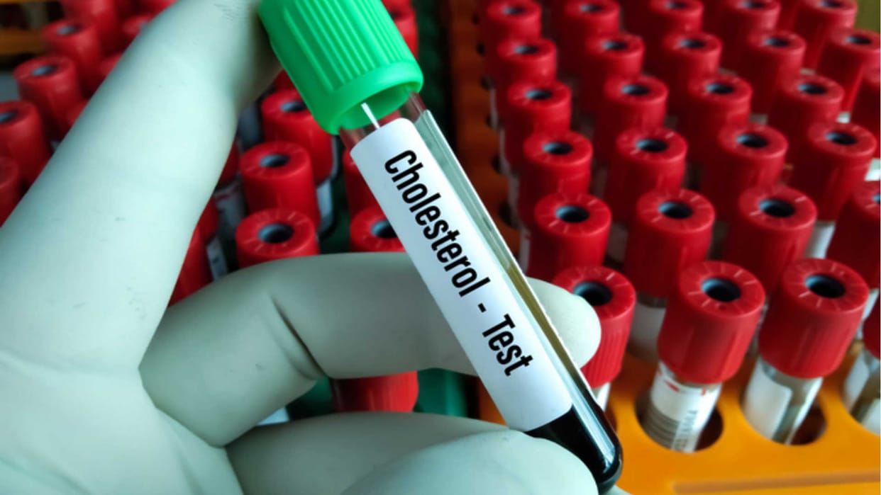 high cholesterol in young age in india, how does cholesterol affect heart disease