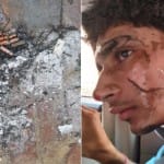 बम फटने से झुलसा पड़ोसी युवक