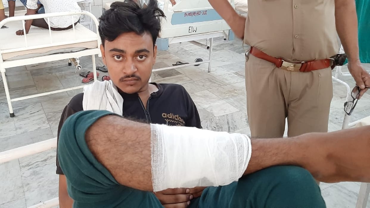Moradabad Police-rogue encounter in Pakbara area, accused shot in the leg constable also injured